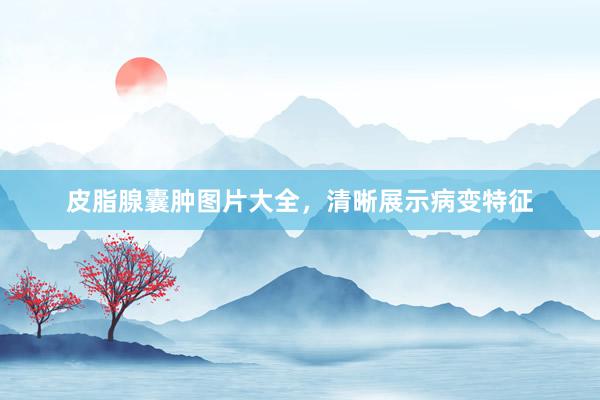 皮脂腺囊肿图片大全，清晰展示病变特征